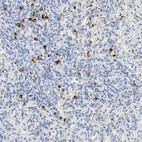 Immunohistochemical staining of human spleen shows strong cytoplasmic positivity in cells in red pulp.