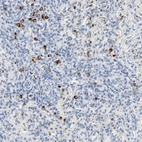 Immunohistochemical staining of human spleen shows strong cytoplasmic positivity in cells in red pulp.