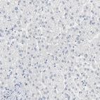 Immunohistochemical staining of human liver shows no positivity in hepatocytes as expected.