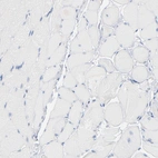 Immunohistochemical staining of human skeletal muscle shows no positivity in myocytes as expected.