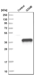Western blot analysis in control (vector only transfected HEK293T lysate) and gZMB over-expression lysate (Co-expressed with a C-terminal myc-DDK tag (~3.1 kDa) in mammalian HEK293T cells, LY401332).