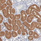 Anti-ZDHHC8 Antibody