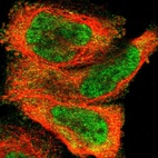 Immunofluorescent staining of human cell line A-431 shows localization to nucleoplasm & cytosol.