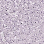 Immunohistochemical staining of human liver shows low expression as expected.
