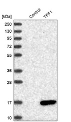 Anti-TFF1 Antibody