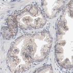 Anti-ADRB2 Antibody