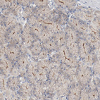 Immunohistochemical staining of human Stomach shows weak membranous positivity in glandular cells.
