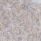 Anti-ADRB2 Antibody