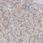 Immunohistochemical staining of human Stomach shows weak membranous positivity in glandular cells.