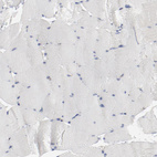 Anti-ADRB2 Antibody