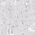 Immunohistochemical staining of human Skeletal muscle shows very weak membranous positivity in myocytes.