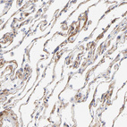 Immunohistochemical staining of human lung shows weak to moderate membranous positivity in pneumocytes.