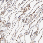 Immunohistochemical staining of human lung shows weak to moderate membranous positivity in pneumocytes.