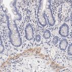 Anti-ITGA8 Antibody