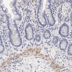 Immunohistochemical staining of human small intestine shows weak to moderate membranous positivity in smooth muscle cells.