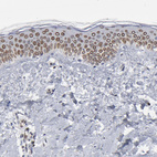 Anti-SYNE2 Antibody