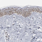 Immunohistochemical staining of human skin shows moderate positivity in nuclear membrane in squamous epithelial cells.
