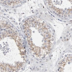 Immunohistochemical staining of human testis shows moderate membranous positivity in cells in seminiferous ducts.