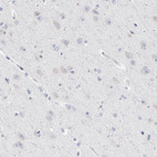 Immunohistochemical staining of human cerebral cortex shows no positivity in neurons as expected.