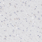 Anti-SYNE2 Antibody