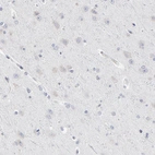 Immunohistochemical staining of human cerebral cortex shows no positivity in neurons as expected.