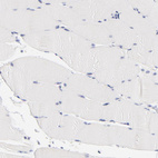 Immunohistochemical staining of human skeletal muscle shows no nuclear positivity in myocytes as expected.