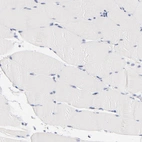 Immunohistochemical staining of human skeletal muscle shows no nuclear positivity in myocytes as expected.
