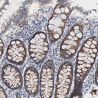 Immunohistochemical staining of human colon shows moderate granular cytoplasmic positivity in glandular cells.