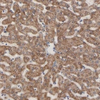 Immunohistochemical staining of human liver shows moderate granular cytoplasmic positivity in hepatocytes.