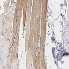 Immunohistochemical staining of human skeletal muscle shows moderate cytoplasmic positivity in myocytes.