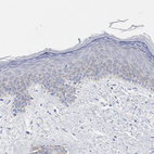 Anti-CHCHD10 Antibody