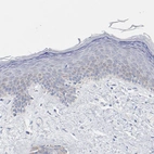 Immunohistochemical staining of human skin shows no positivity in squamous epithelial cells as expected.