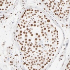 Anti-ZNF540 Antibody