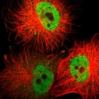 Immunofluorescent staining of human cell line U-251 MG shows localization to nucleoplasm & vesicles.