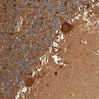 Anti-IQCJ-SCHIP1 Antibody