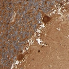 Anti-IQCJ-SCHIP1 Antibody