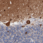 Anti-SHANK3 Antibody