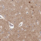 Immunohistochemical staining of human cerebral cortex shows moderate positivity in neuropil.