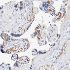 Immunohistochemical staining of human placenta shows strong positivity in endothelial cells.