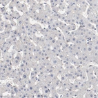 Immunohistochemical staining of human liver shows no positivity in hepatocytes as expected.