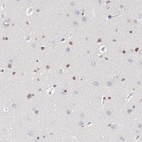 Anti-ZEB2 Antibody