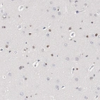 Anti-ZEB2 Antibody