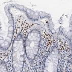 Immunohistochemical staining of human colon shows strong nuclear positivity in a subset of lymphoid cells.