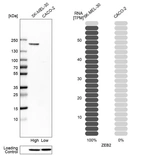 Western blot analysis in human cell lines SK-MEL-30 and Caco-2 using Anti-ZEB2 antibody. Corresponding ZEB2 RNA-seq data are presented for the same cell lines. Loading control: Anti-HDAC1.