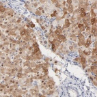 Immunohistochemical staining of human liver shows high expression.