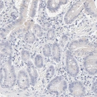 Immunohistochemical staining of human small intestine shows low expression as expected.