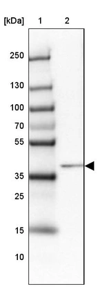 Lane 1: Marker [kDa] 250, 130, 100, 70, 55, 35, 25, 15, 10_br/_Lane 2: Human Liver tissue