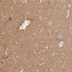 Immunohistochemical staining of human cerebral cortex shows moderate cytoplasmic positivity in neuropil.
