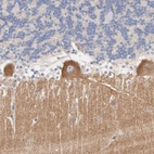 Immunohistochemical staining of human cerebellum shows moderate cytoplasmic positivity in Purkinje cells.