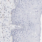 Immunohistochemical staining of human skin shows no positivity in squamous epithelial cells as expected.